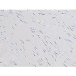 Phospho-Smad3 (Ser213) Antibody in Immunohistochemistry (Paraffin) (IHC (P))