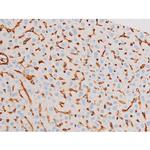 Phospho-Smad3 (Ser213) Antibody in Immunohistochemistry (Paraffin) (IHC (P))