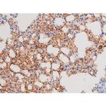 Phospho-Smad3 (Ser213) Antibody in Immunohistochemistry (Paraffin) (IHC (P))