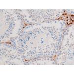 Phospho-Smad3 (Ser213) Antibody in Immunohistochemistry (Paraffin) (IHC (P))