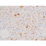 Phospho-Smad3 (Ser213) Antibody in Immunohistochemistry (Paraffin) (IHC (P))