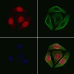 Phospho-FOXO4 (Thr451) Antibody in Immunocytochemistry (ICC/IF)