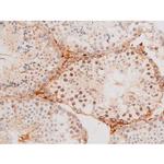 Phospho-FOXO4 (Thr451) Antibody in Immunohistochemistry (Paraffin) (IHC (P))