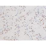 Phospho-FOXO4 (Thr451) Antibody in Immunohistochemistry (Paraffin) (IHC (P))