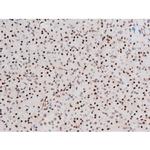 Phospho-FOXO4 (Thr451) Antibody in Immunohistochemistry (Paraffin) (IHC (P))