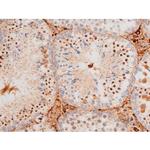 Phospho-FOXO4 (Thr451) Antibody in Immunohistochemistry (Paraffin) (IHC (P))