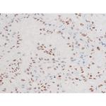 Phospho-FOXO4 (Thr451) Antibody in Immunohistochemistry (Paraffin) (IHC (P))