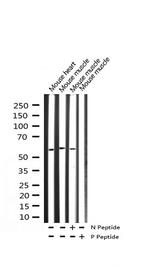 Phospho-FOXO4 (Thr451) Antibody in Western Blot (WB)