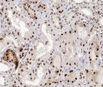 Phospho-NFkB p100 (Ser866) Antibody in Immunohistochemistry (Paraffin) (IHC (P))