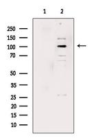 Phospho-NFkB p100 (Ser866) Antibody in Western Blot (WB)