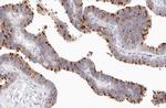 Phospho-NFkB p52/p100 (Ser870) Antibody in Immunohistochemistry (Paraffin) (IHC (P))