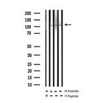 Phospho-NFkB p52/p100 (Ser870) Antibody in Western Blot (WB)