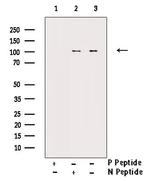 Phospho-NFkB p100 (Ser872) Antibody in Western Blot (WB)