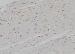 Phospho-RUNX1 (Ser304) Antibody in Immunohistochemistry (Paraffin) (IHC (P))