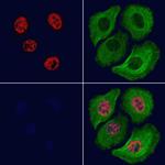 Phospho-MEF2A (Thr312) Antibody in Immunocytochemistry (ICC/IF)