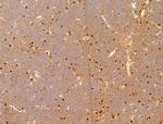 Phospho-NFkB p65 (Ser276) Antibody in Immunohistochemistry (Paraffin) (IHC (P))