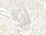 Phospho-NFkB p65 (Ser276) Antibody in Immunohistochemistry (Paraffin) (IHC (P))