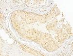 Phospho-NFkB p65 (Ser276) Antibody in Immunohistochemistry (Paraffin) (IHC (P))