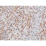 Phospho-NFkB p65 (Thr435) Antibody in Immunohistochemistry (Paraffin) (IHC (P))