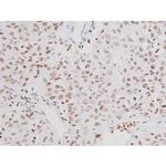 Phospho-NFkB p65 (Thr435) Antibody in Immunohistochemistry (Paraffin) (IHC (P))