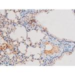 Phospho-NFkB p65 (Thr435) Antibody in Immunohistochemistry (Paraffin) (IHC (P))