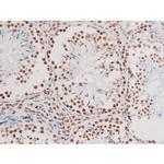 Phospho-NFkB p65 (Thr435) Antibody in Immunohistochemistry (Paraffin) (IHC (P))