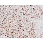 Phospho-NFkB p65 (Thr435) Antibody in Immunohistochemistry (Paraffin) (IHC (P))