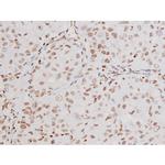 Phospho-NFkB p65 (Thr435) Antibody in Immunohistochemistry (Paraffin) (IHC (P))