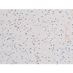 Phospho-NFkB p65 (Thr435) Antibody in Immunohistochemistry (Paraffin) (IHC (P))