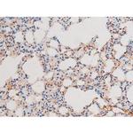 Phospho-NFkB p65 (Thr435) Antibody in Immunohistochemistry (Paraffin) (IHC (P))