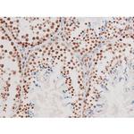 Phospho-NFkB p65 (Thr435) Antibody in Immunohistochemistry (Paraffin) (IHC (P))