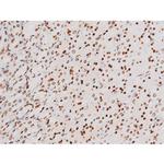 Phospho-NFkB p65 (Thr435) Antibody in Immunohistochemistry (Paraffin) (IHC (P))