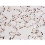 Phospho-NFkB p65 (Thr435) Antibody in Immunohistochemistry (Paraffin) (IHC (P))