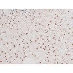 Phospho-NFkB p65 (Ser281) Antibody in Immunohistochemistry (Paraffin) (IHC (P))