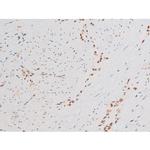 Phospho-NFkB p65 (Ser281) Antibody in Immunohistochemistry (Paraffin) (IHC (P))