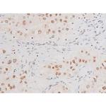 Phospho-NFkB p65 (Ser281) Antibody in Immunohistochemistry (Paraffin) (IHC (P))