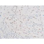 Phospho-NFkB p65 (Ser281) Antibody in Immunohistochemistry (Paraffin) (IHC (P))