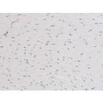 Phospho-NFkB p65 (Ser281) Antibody in Immunohistochemistry (Paraffin) (IHC (P))