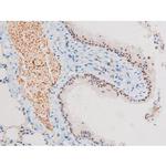 Phospho-NFkB p65 (Ser281) Antibody in Immunohistochemistry (Paraffin) (IHC (P))