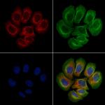 Phospho-FAK (Tyr576) Antibody in Immunocytochemistry (ICC/IF)