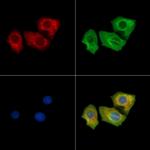 Phospho-FAK (Tyr576) Antibody in Immunocytochemistry (ICC/IF)