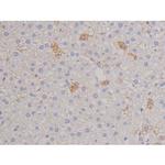 Phospho-FAK (Tyr576) Antibody in Immunohistochemistry (Paraffin) (IHC (P))