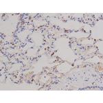 Phospho-FAK (Tyr576) Antibody in Immunohistochemistry (Paraffin) (IHC (P))