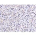 Phospho-FAK (Tyr576) Antibody in Immunohistochemistry (Paraffin) (IHC (P))