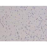 Phospho-FAK (Tyr576) Antibody in Immunohistochemistry (Paraffin) (IHC (P))