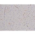 Phospho-FAK (Tyr576) Antibody in Immunohistochemistry (Paraffin) (IHC (P))