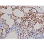 Phospho-FAK (Tyr576) Antibody in Immunohistochemistry (Paraffin) (IHC (P))