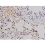 Phospho-FAK (Tyr576) Antibody in Immunohistochemistry (Paraffin) (IHC (P))