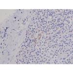 Phospho-FAK (Tyr576) Antibody in Immunohistochemistry (Paraffin) (IHC (P))