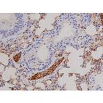 Phospho-FAK (Tyr576) Antibody in Immunohistochemistry (Paraffin) (IHC (P))